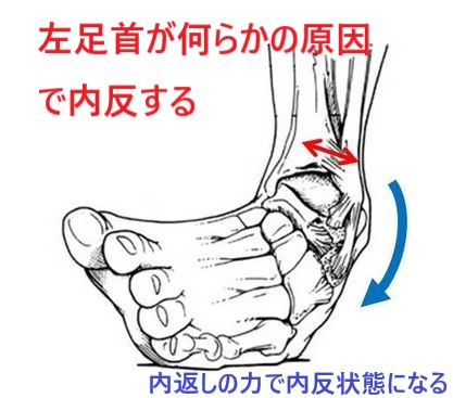 左足首に内返しの力が加わることで左足首が内反状態になる