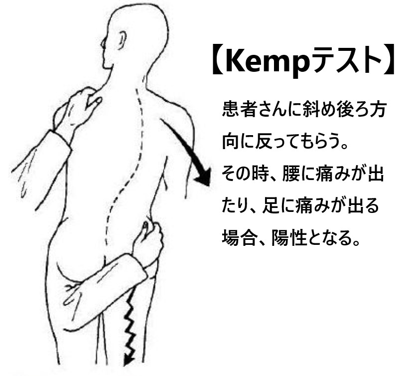 腰部脊柱管狭窄症の整形外科的検査であるKemp（ケンプ）テストの説明