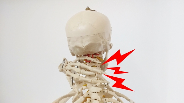 骨格模型を使って斜頸で首の痛みが出やすいメカニズムを説明する院長